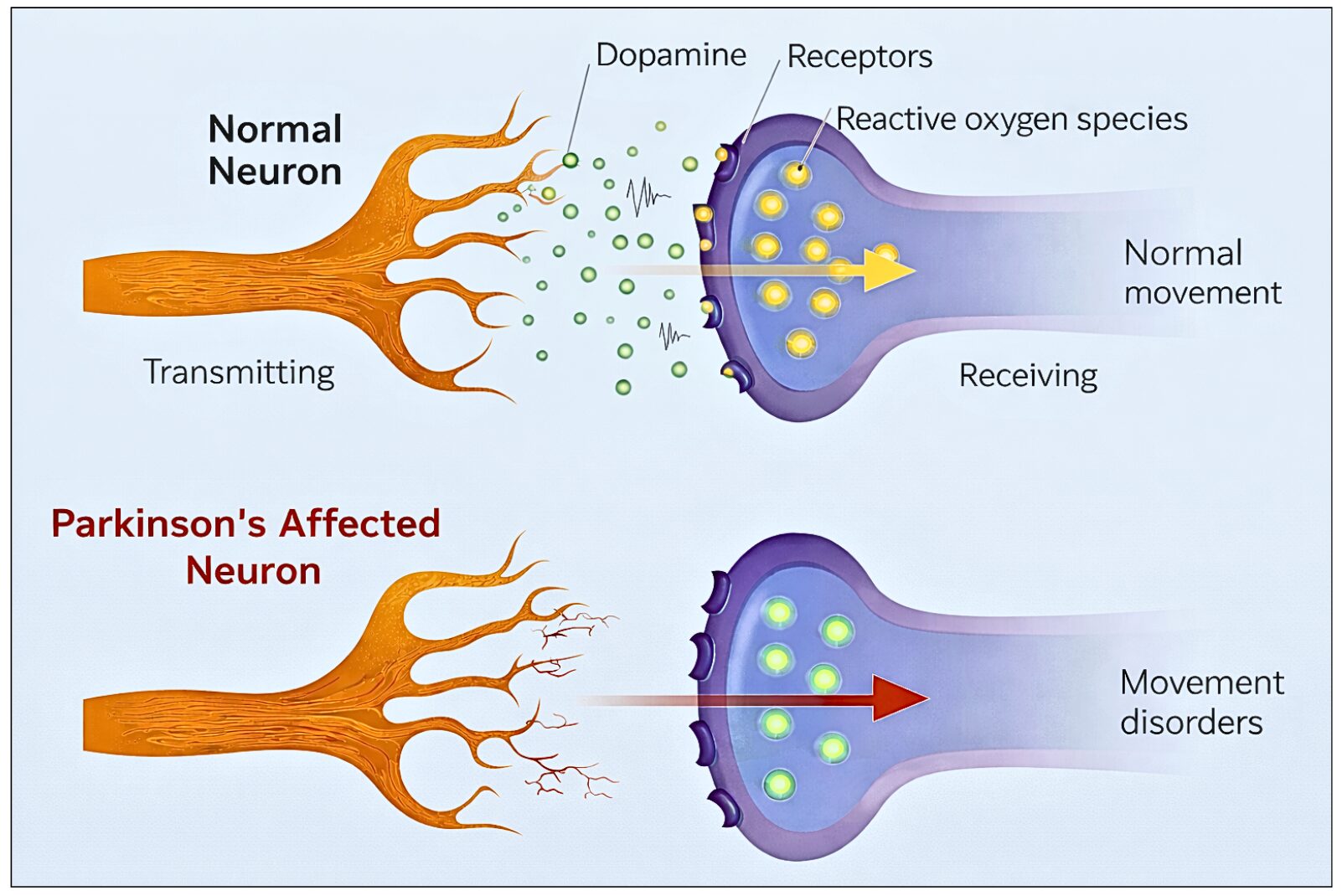Parkinson's Disease