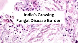 India’s Growing Fungal Disease Burden