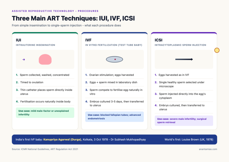Three Main ART Techniques: IUI, IVF, ICSI