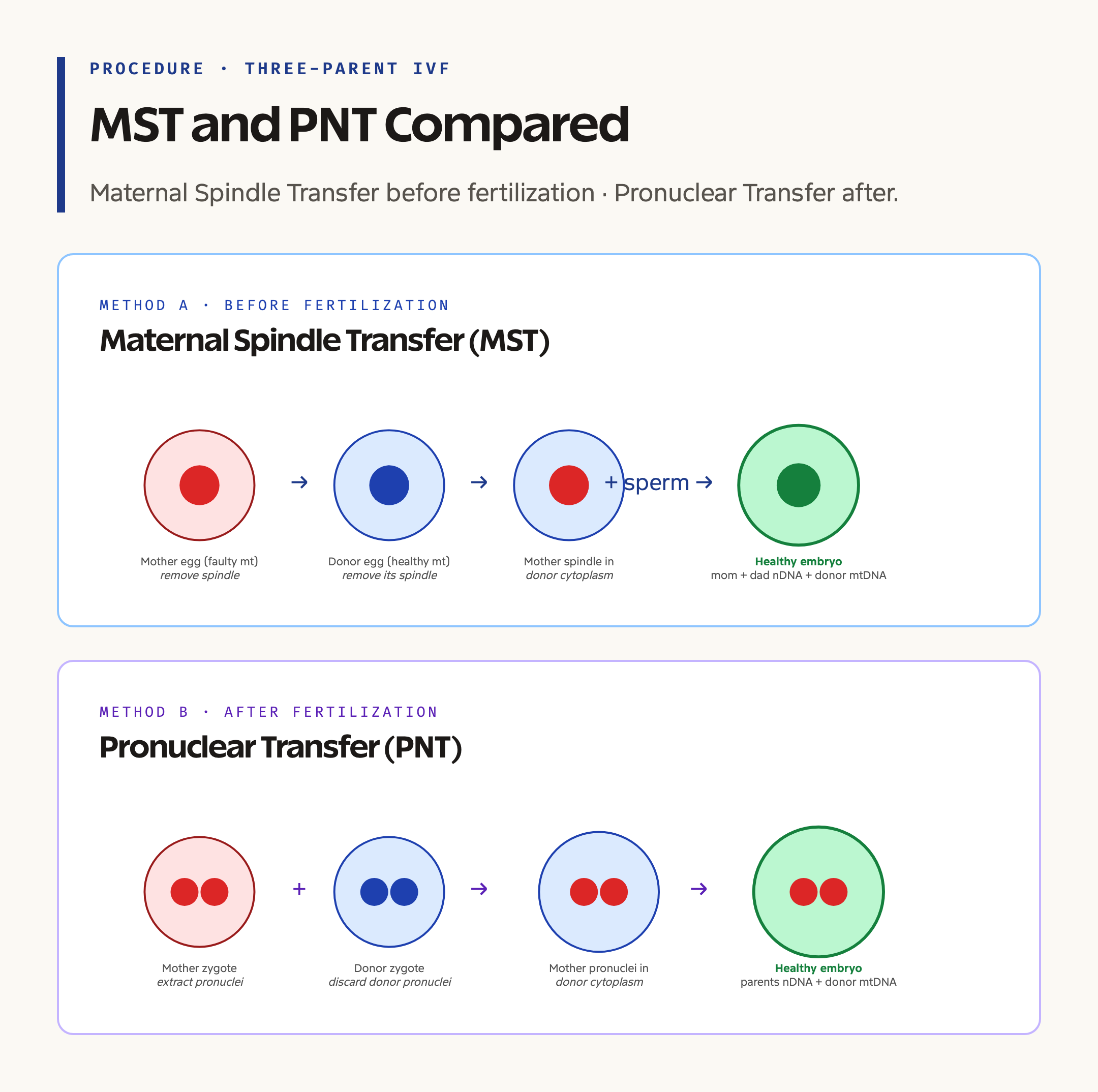 Three-Parent IVF: Maternal Spindle Transfer and Pronuclear Transfer