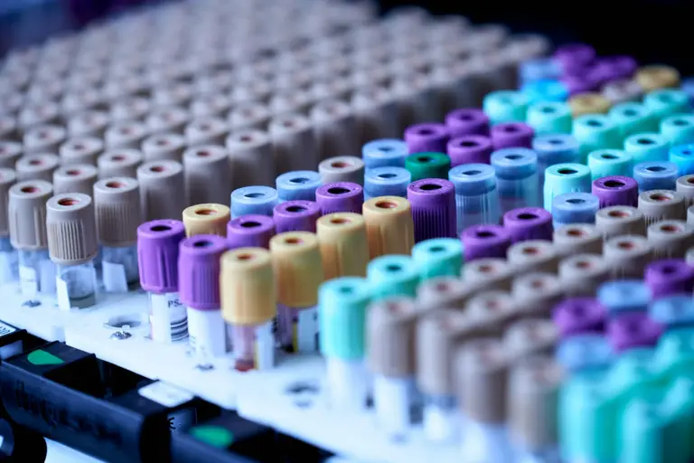 Sample vials in a rack in a medical laboratory