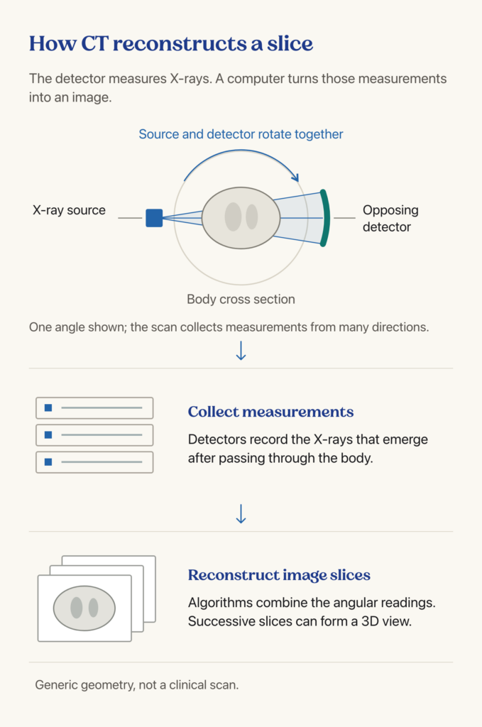 CT schematic showing a rotating X-ray source, opposing detector and reconstruction of measurements into image slices